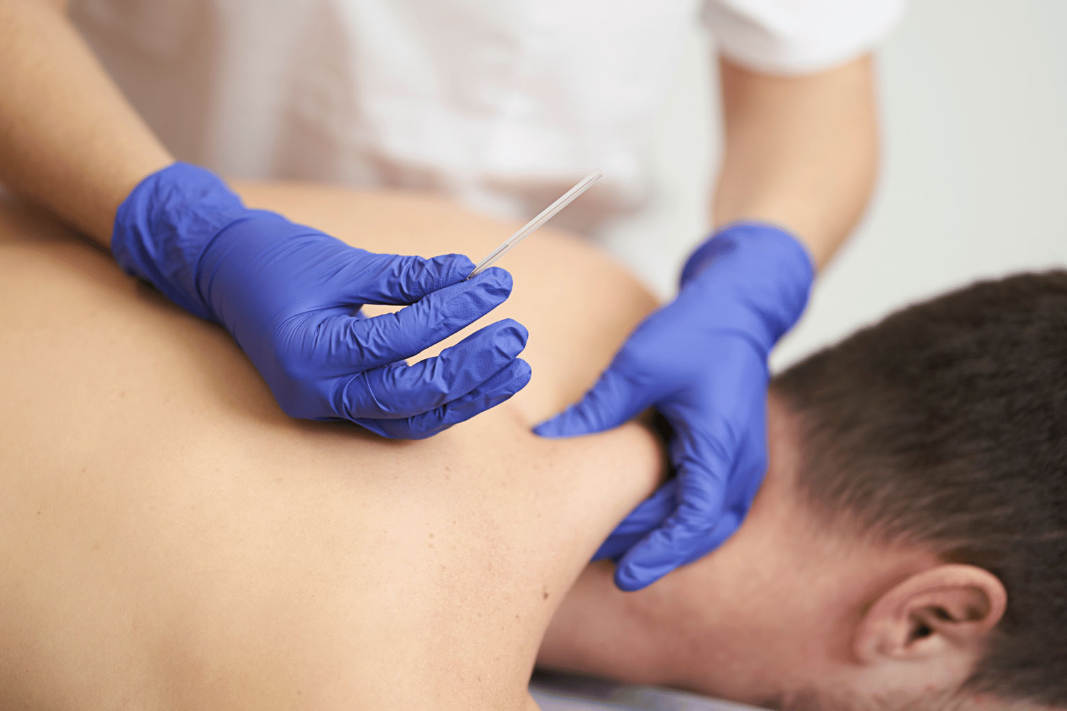 Best acupuncture treatment for neck pain Hyderabad