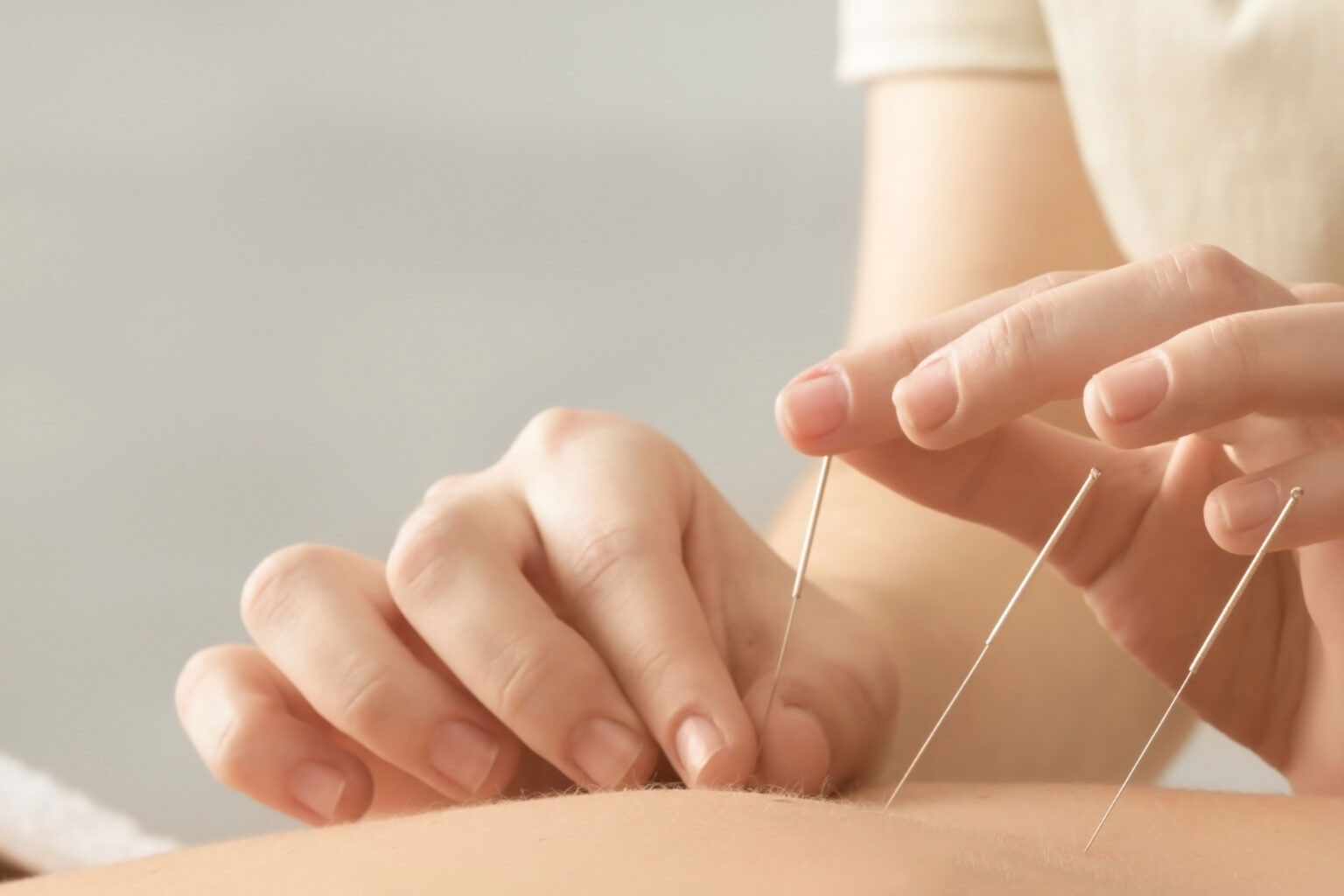 Best acupuncture treatment for sleep disorder Hyderabad